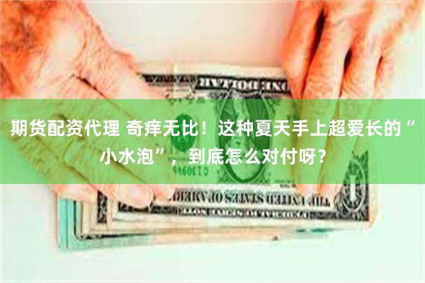 期货配资代理 奇痒无比！这种夏天手上超爱长的“小水泡”，到底怎么对付呀？